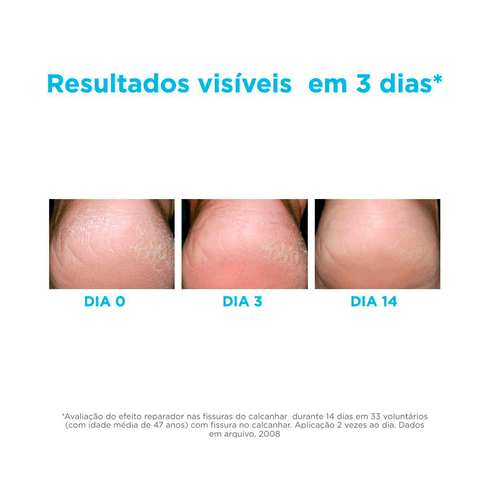 Gel-Hidratante-para-os-Pes-Isdin---Ureadin-Podos-3